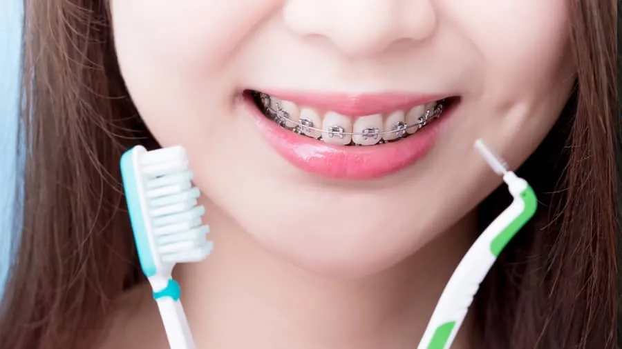 Het belang van de juiste tandenborstel en tandpasta voor orthodontische patiënten