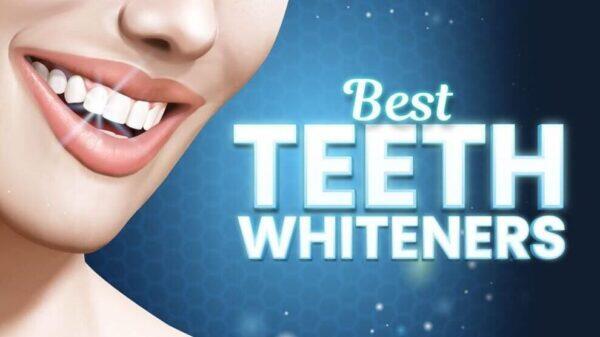 Tanden Tips - Beste Tandenbleker