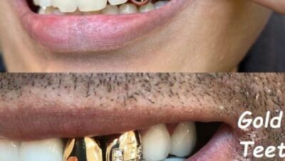 Tanden Tips - Gouden Tand