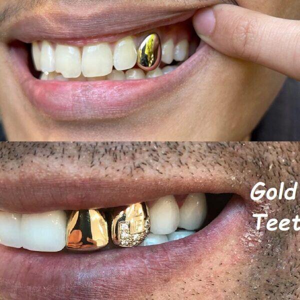 Tanden Tips - Gouden Tand