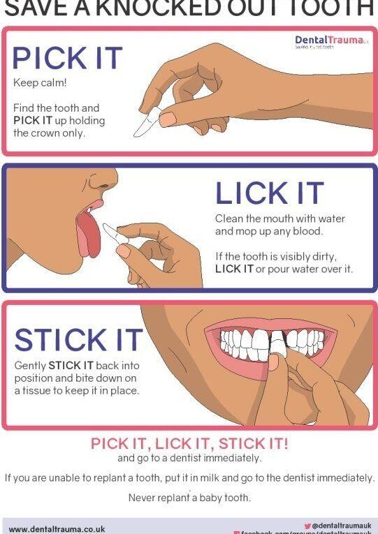 Tanden Tips - Gebitsreiniging