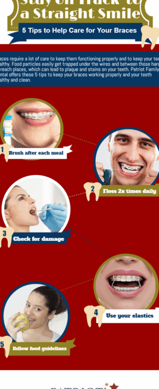 Tanden Tips - Permanente Beugel