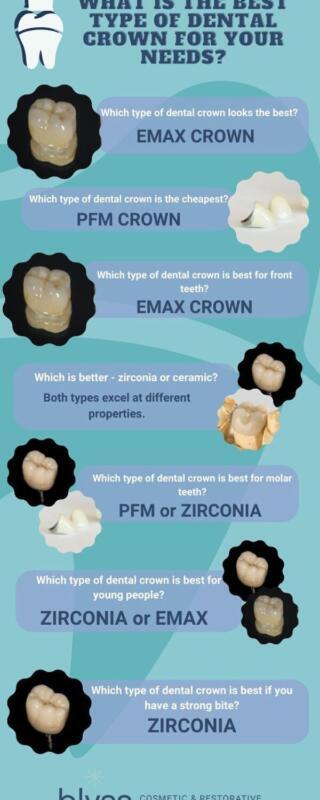 Tanden Tips - Esthetische Kronen