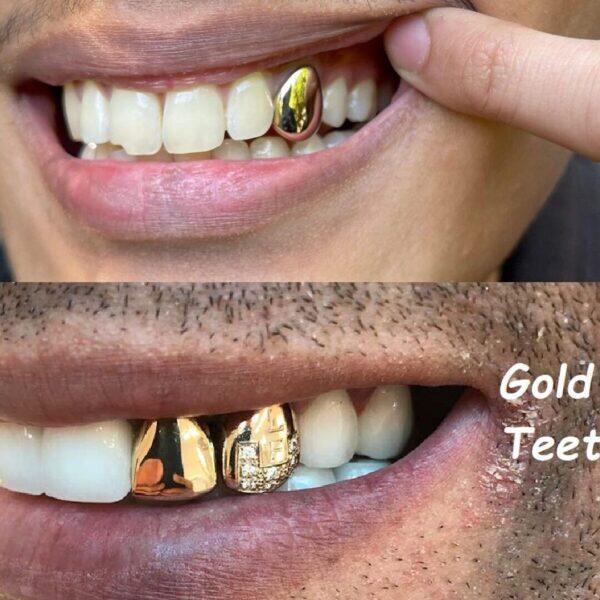 Tanden Tips - Gouden Tand