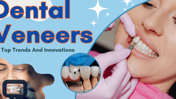 Tanden Tips - Facings Vergelijken