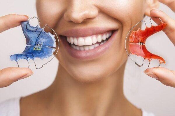 Tanden Tips - Retainer