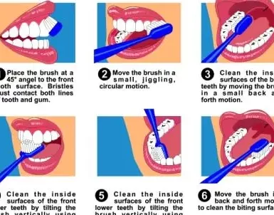 Tanden Tips - Preventieve Tandheelkunde