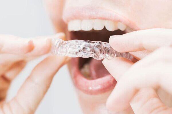 Tanden Tips - Invisalign