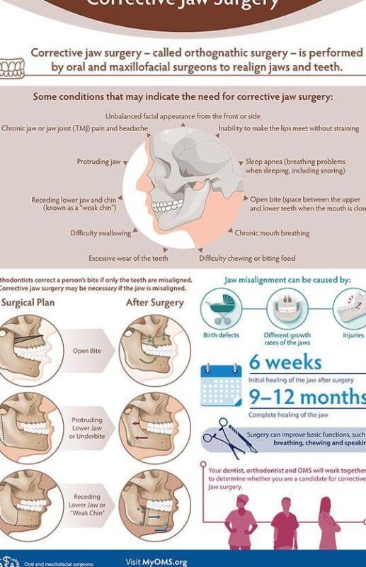 Tanden Tips - Orthodontie Kinderen