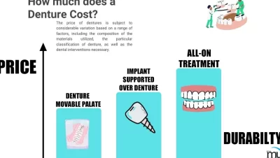 Tanden Tips - Kosten Kunstgebit