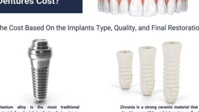 Tanden Tips - Kunstgebitten