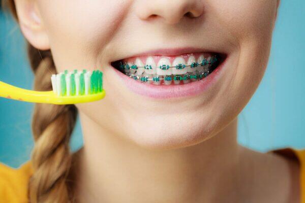 Tanden Tips - Orthodontie Kinderen