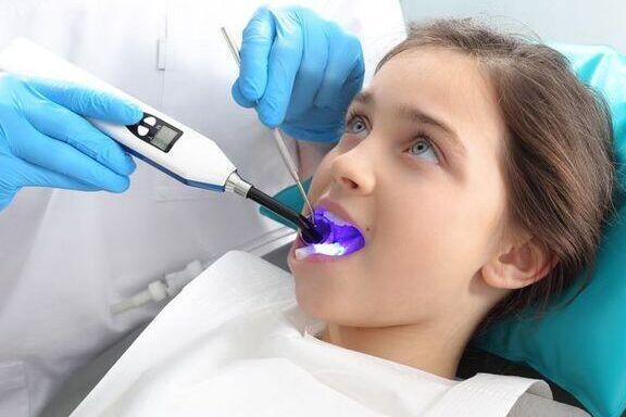 Tanden Tips - Sealants bij Kinderen