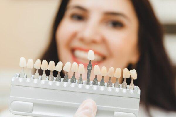 Tanden Tips - Esthetische Tandheelkundige Oplossingen