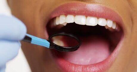 Tanden Tips - Cosmetische Tandheelkunde