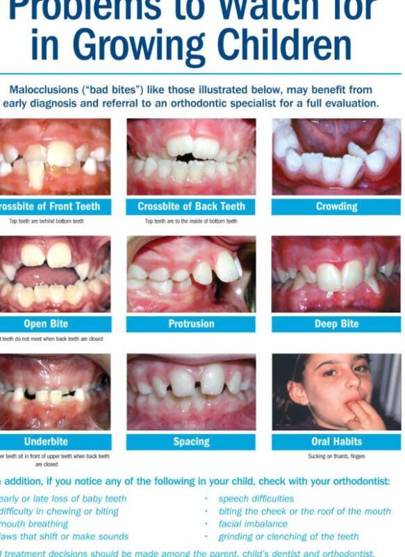 Tanden Tips - Orthodontie voor Kinderen