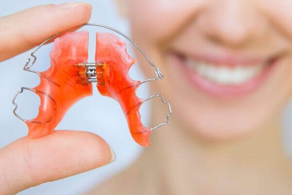 Tanden Tips - Retainer