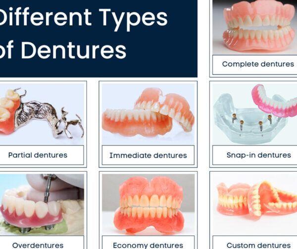 Tanden Tips - Gebitsprothese Laten Maken