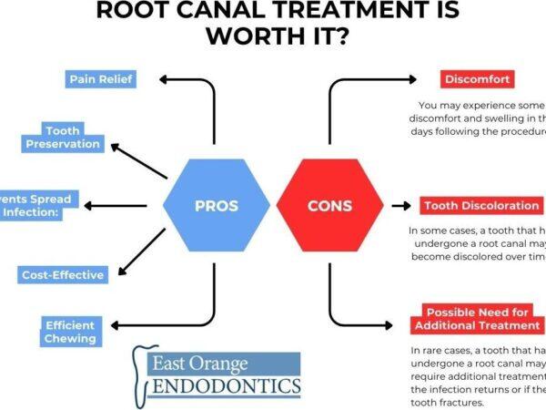 Tanden Tips - Endodontie Procedure