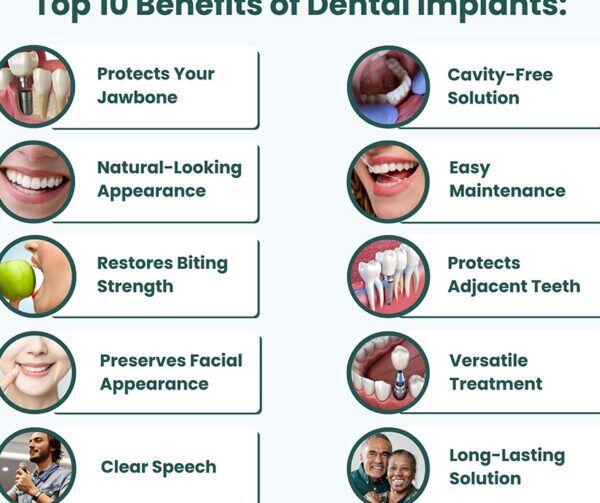 Tanden Tips - Implantaten