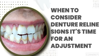 Tanden Tips - Aanpassen Kunstgebit