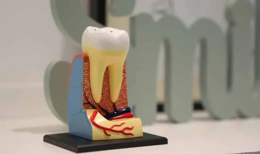 Voordelen van het gebruik van sealants bij melktanden