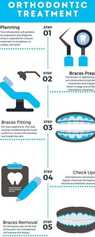 Tanden Tips - Orthodontie