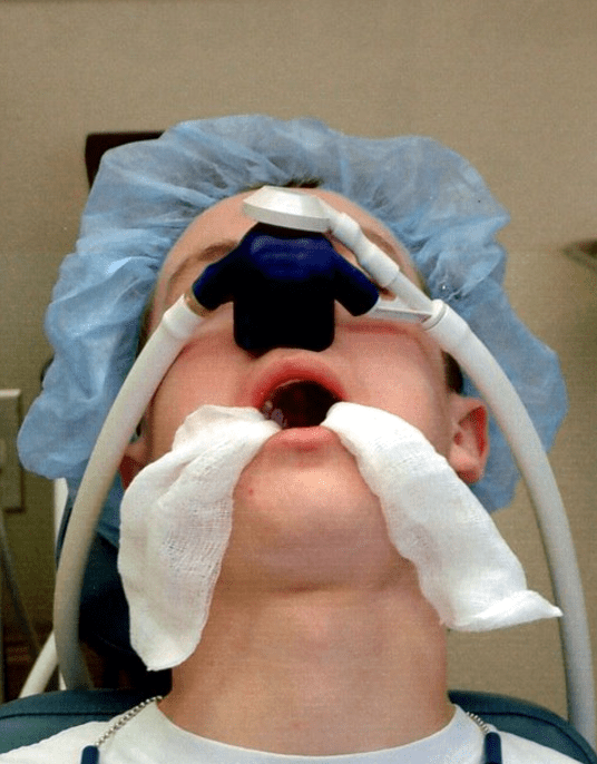 Tanden Tips - Algehele Anesthesie Tandarts