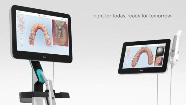 Tanden Tips - Digitale Kronen