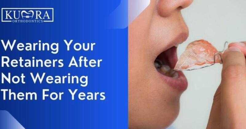 Tanden Tips - Retainer