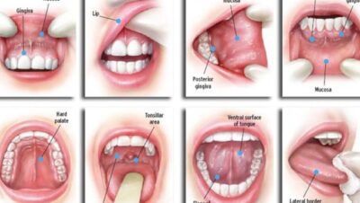 Tanden Tips - Acute Kiespijn