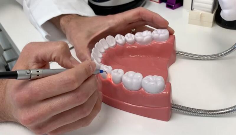 Tanden Tips - Laserbehandeling Parodontitis