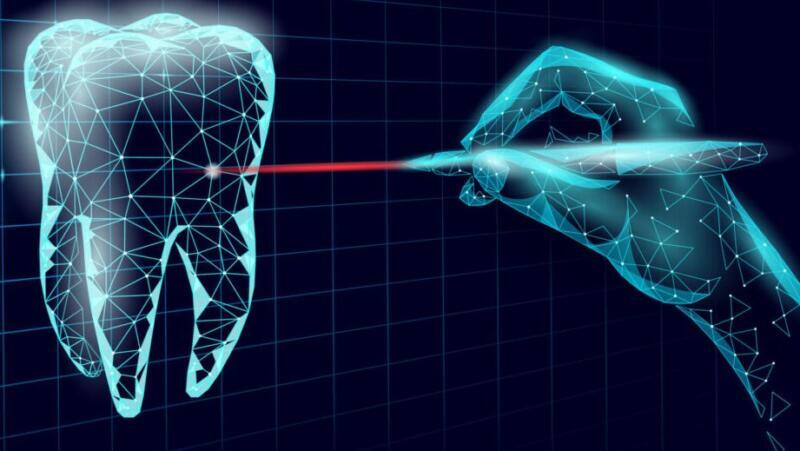 Tanden Tips - Laserbehandeling Parodontitis