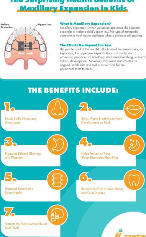 Tanden Tips - Orthodontische Expander
