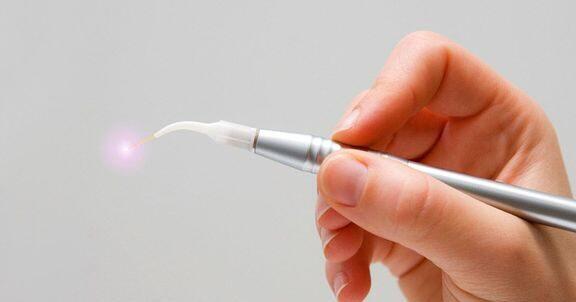 Tanden Tips - Laserbehandeling Parodontitis