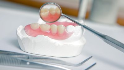 Tanden Tips - Gebitsprothese Laten Maken