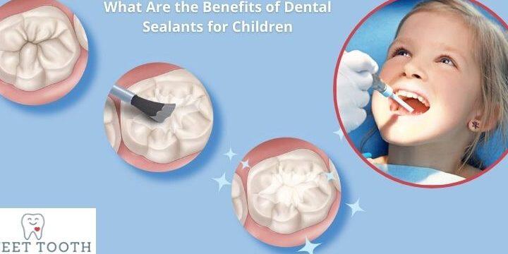 Tanden Tips - Sealants bij Kinderen