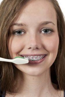 Tanden Tips - Orthodontie Kinderen