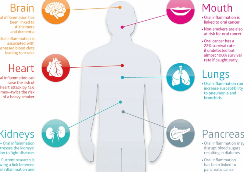 Tanden Tips - Mondgezondheid Meten