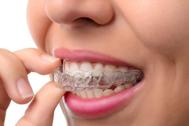 Tanden Tips - Retainer