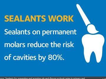 Tanden Tips - Sealants bij Kinderen