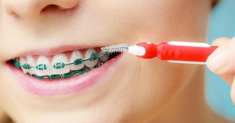 Tanden Tips - Orthodontie voor Kinderen