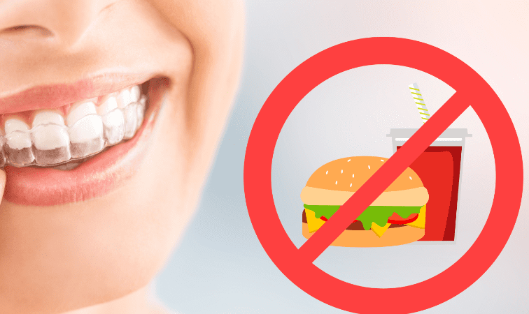 Tanden Tips - Invisalign