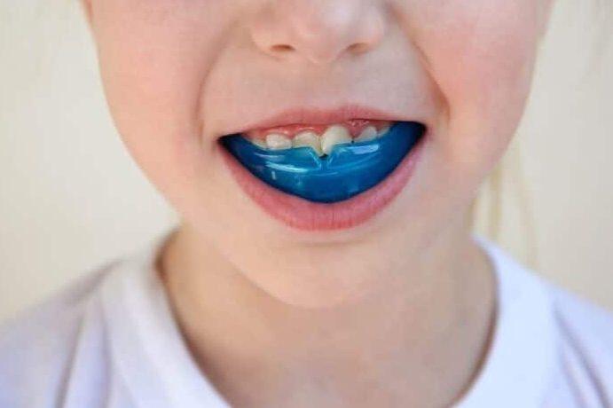 Tanden Tips - Retainer