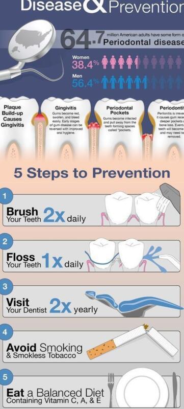 Tanden Tips - Mondgezondheid