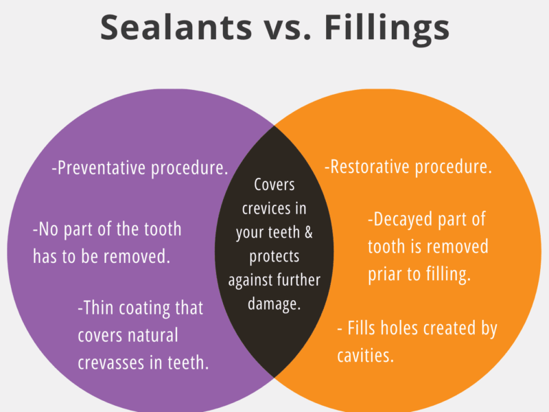 Tanden Tips - Sealants bij Kinderen