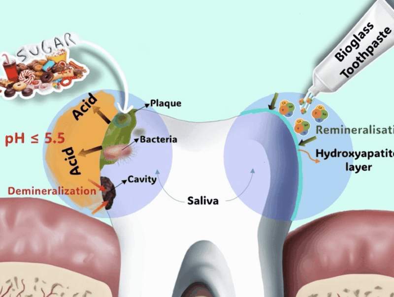 Tanden Tips - Tandpasta zonder Fluoride