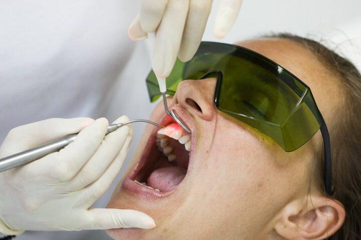 Tanden Tips - Endodontie Procedure