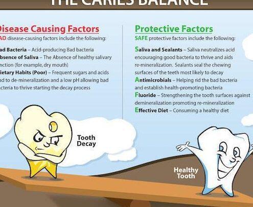 Tanden Tips - Fluoride Behandeling