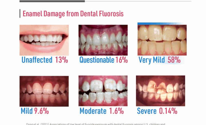 Tanden Tips - Fluoride Behandeling